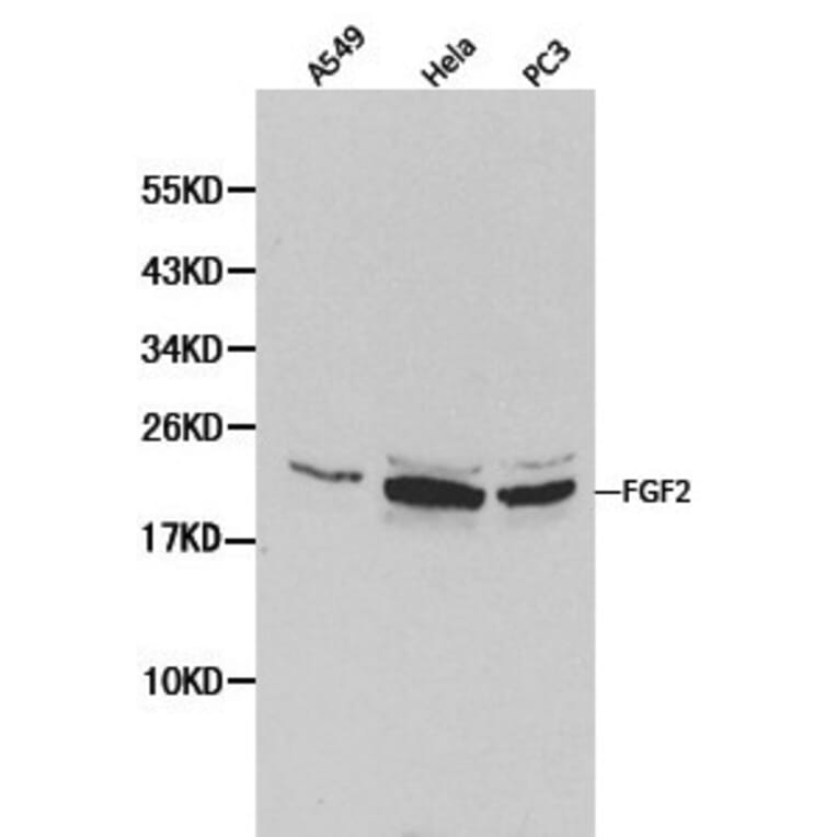 Anti-FGF Basic (FGF2) Antibody from Bioworld Technology (BS6432) - Antibodies.com