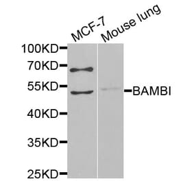 Anti-BAMBI Antibody from Bioworld Technology (BS6435) - Antibodies.com