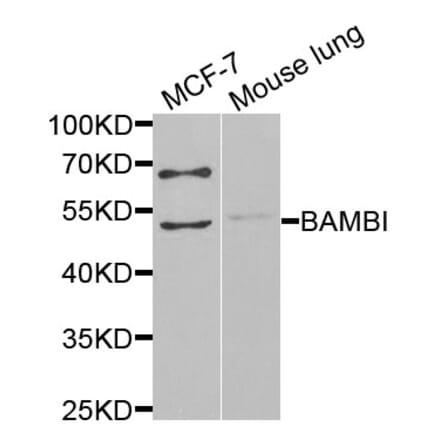 Anti-BAMBI Antibody from Bioworld Technology (BS6435) - Antibodies.com