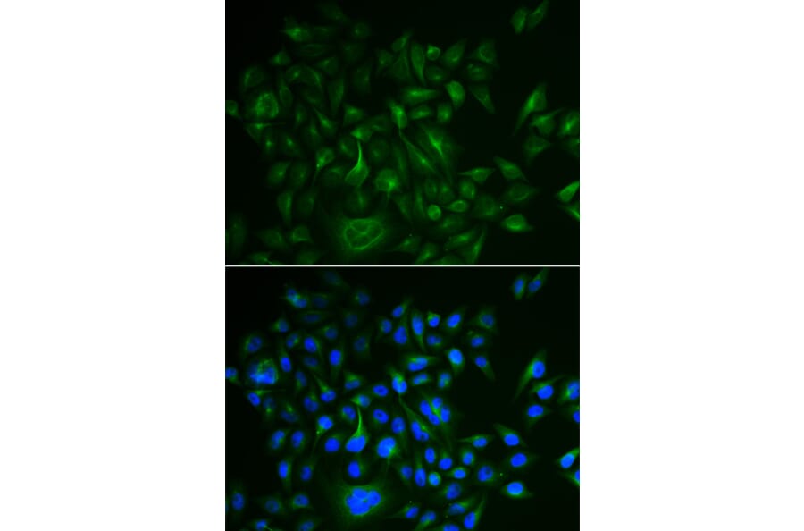 Anti-BAMBI Antibody from Bioworld Technology (BS6435) - Antibodies.com