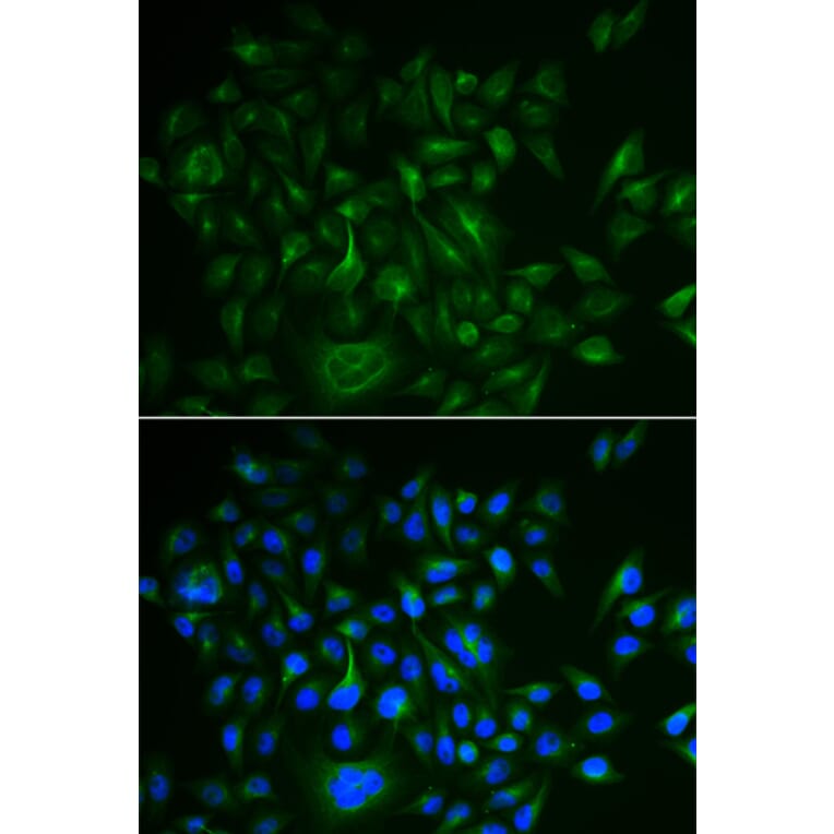 Anti-BAMBI Antibody from Bioworld Technology (BS6435) - Antibodies.com