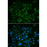 Anti-BAMBI Antibody from Bioworld Technology (BS6435) - Antibodies.com