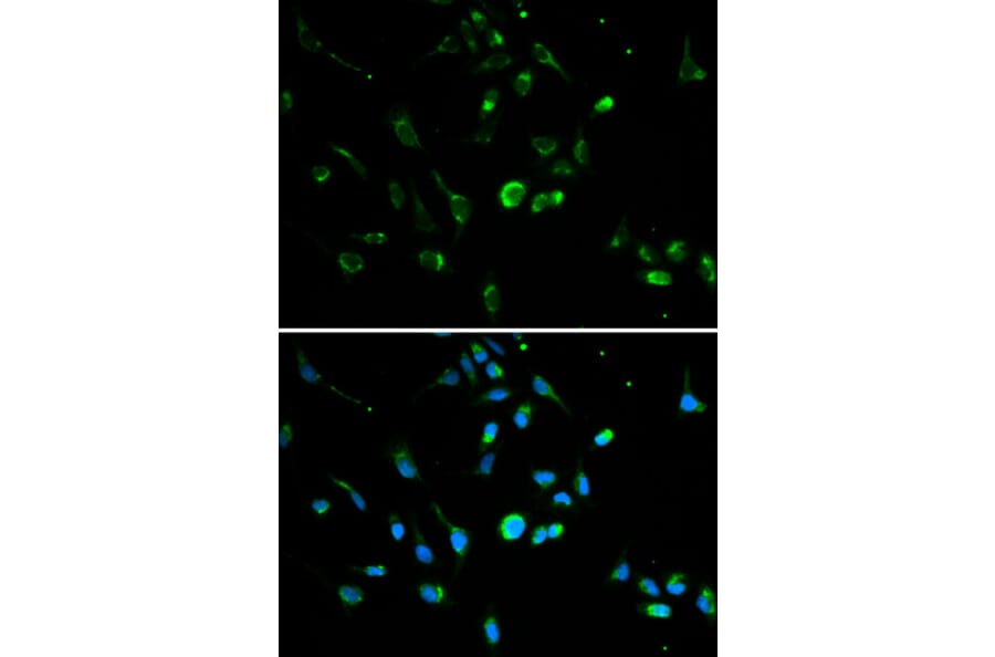 Anti-p53 Antibody from Bioworld Technology (BS6437) - Antibodies.com