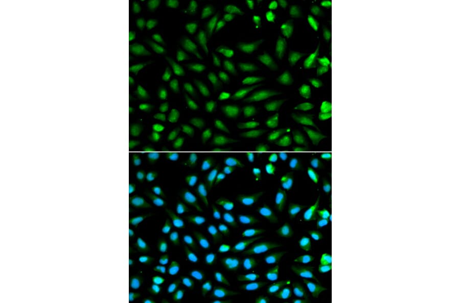Anti-PCNA Antibody from Bioworld Technology (BS6438) - Antibodies.com