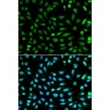 Anti-PCNA Antibody from Bioworld Technology (BS6438) - Antibodies.com
