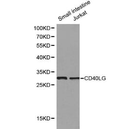 Anti-CD40 Ligand Antibody from Bioworld Technology (BS6439) - Antibodies.com