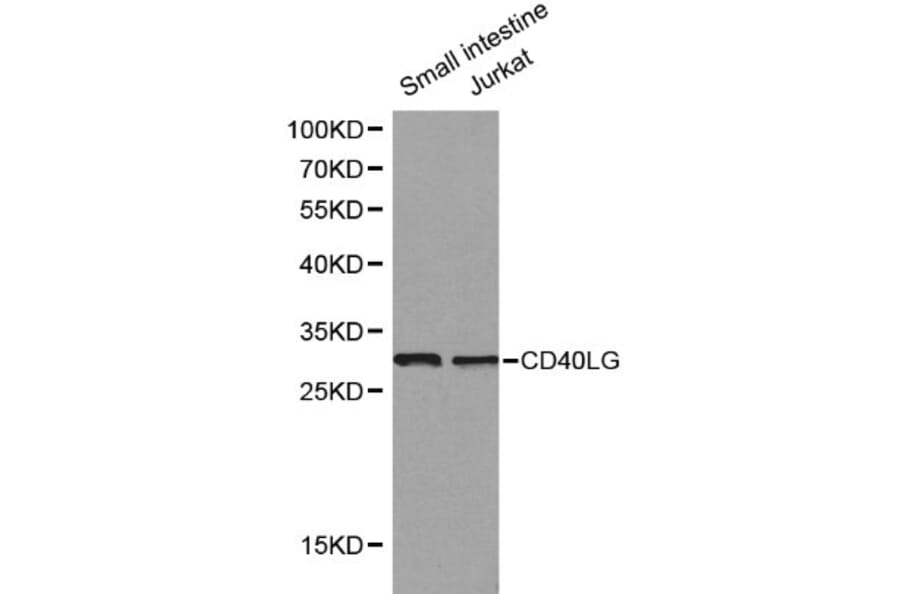 Anti-CD40 Ligand Antibody from Bioworld Technology (BS6439) - Antibodies.com