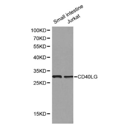 Anti-CD40 Ligand Antibody from Bioworld Technology (BS6439) - Antibodies.com