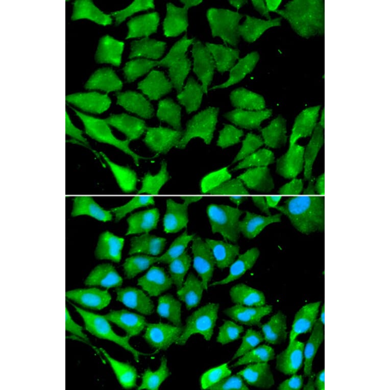 Anti-PPARγ Antibody from Bioworld Technology (BS6442) - Antibodies.com