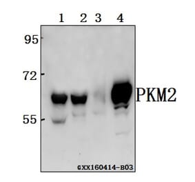 Anti-PKM2 Antibody from Bioworld Technology (BS6443) - Antibodies.com