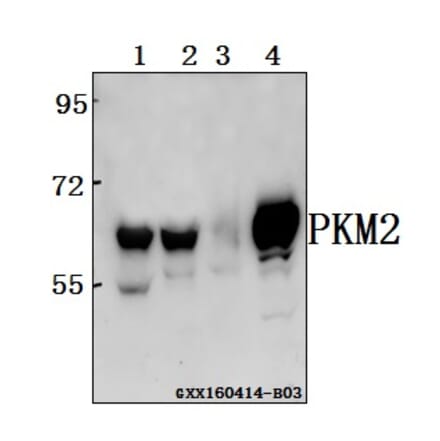 Anti-PKM2 Antibody from Bioworld Technology (BS6443) - Antibodies.com