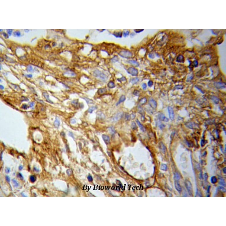 Anti-PKM2 Antibody from Bioworld Technology (BS6443) - Antibodies.com