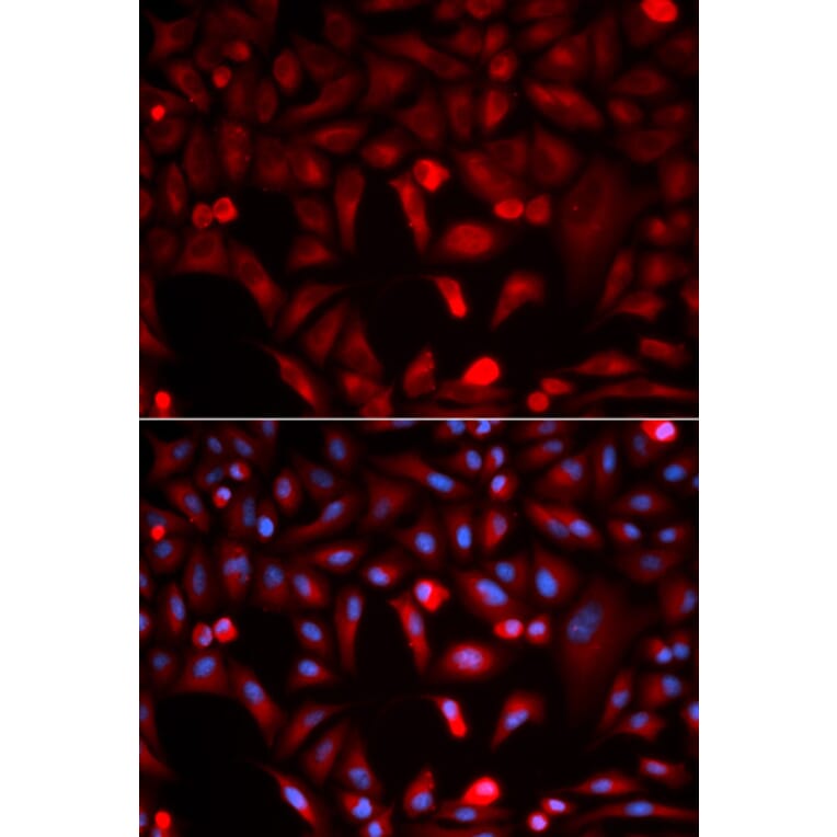 Anti-PKM2 Antibody from Bioworld Technology (BS6443) - Antibodies.com