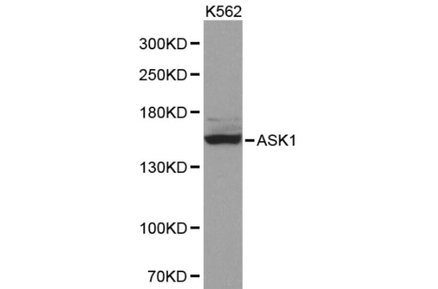 Anti-ASK1 Antibody from Bioworld Technology (BS6445) - Antibodies.com