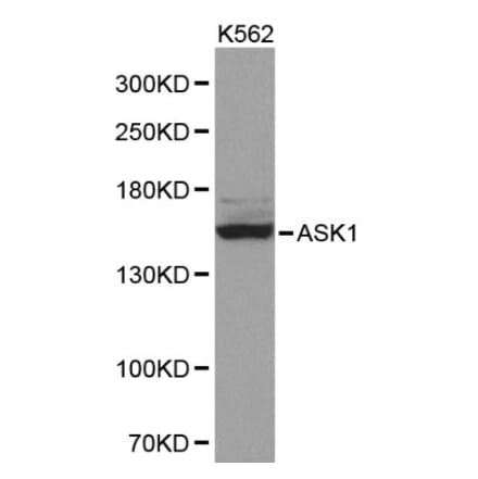 Anti-ASK1 Antibody from Bioworld Technology (BS6445) - Antibodies.com