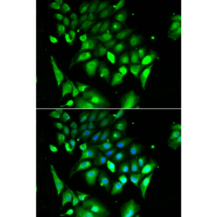 Anti-BHLHB2 Antibody from Bioworld Technology (BS6451) - Antibodies.com