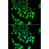 Anti-BHLHB2 Antibody from Bioworld Technology (BS6451) - Antibodies.com