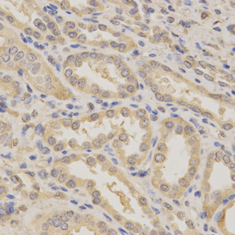 Anti-Bcl-X Antibody from Bioworld Technology (BS6453) - Antibodies.com