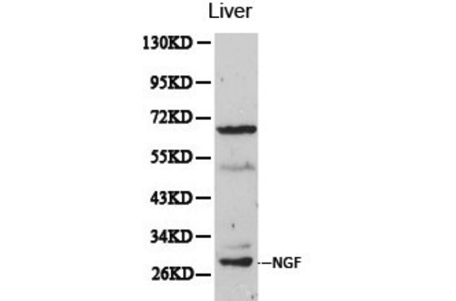 Anti-NGF Antibody from Bioworld Technology (BS6454) - Antibodies.com