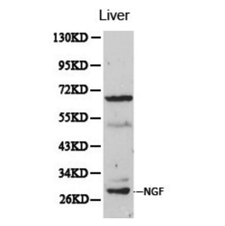 Anti-NGF Antibody from Bioworld Technology (BS6454) - Antibodies.com