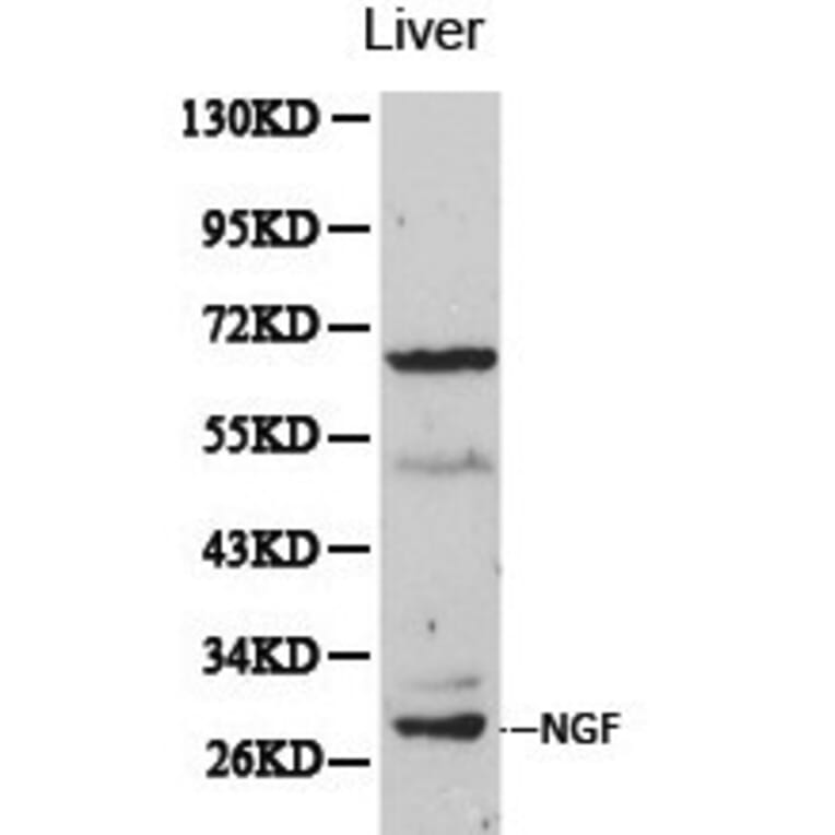 Anti-NGF Antibody from Bioworld Technology (BS6454) - Antibodies.com