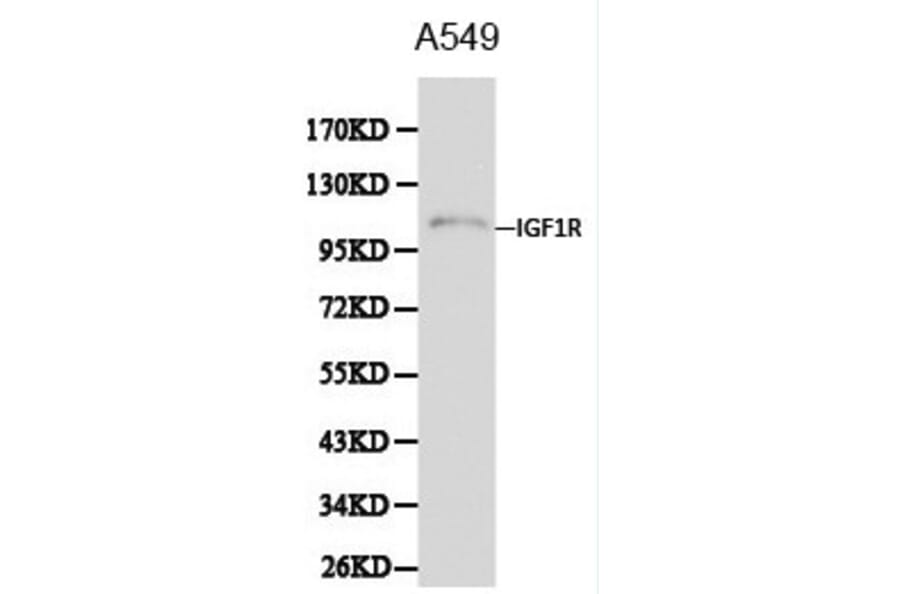 Anti-IGF-IR Antibody from Bioworld Technology (BS6458) - Antibodies.com