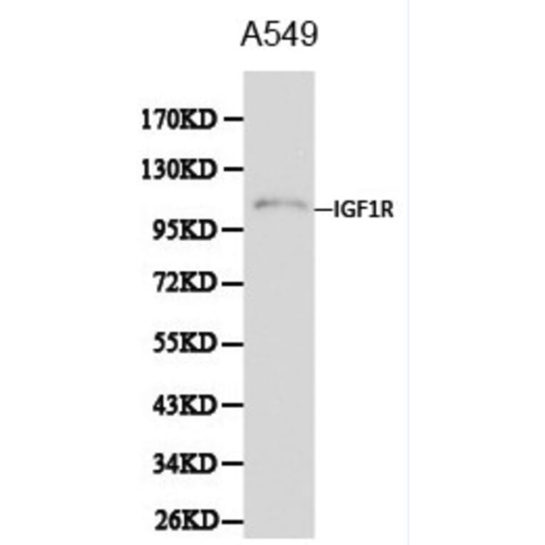 Anti-IGF-IR Antibody from Bioworld Technology (BS6458) - Antibodies.com