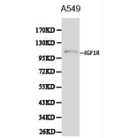 Anti-IGF-IR Antibody from Bioworld Technology (BS6458) - Antibodies.com