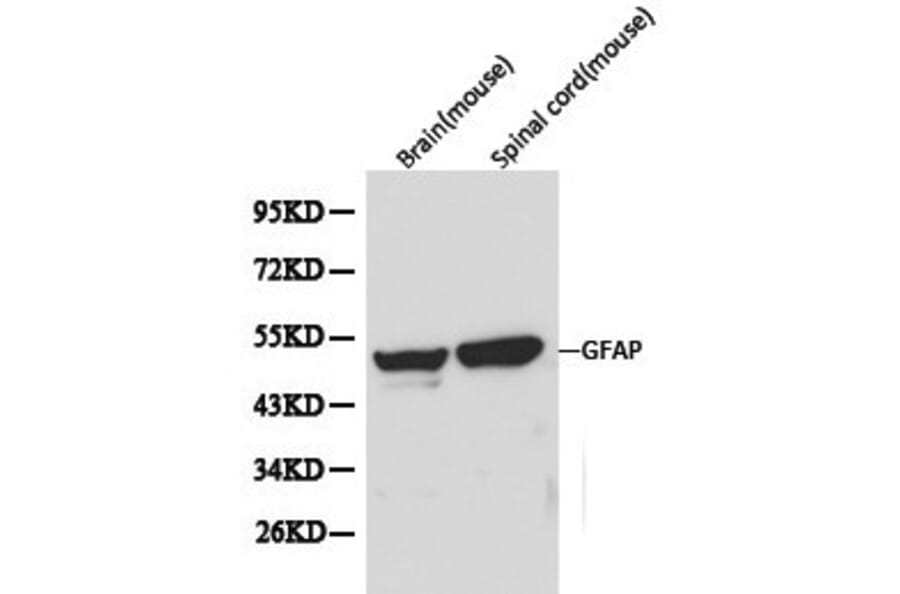 Anti-GFAP Antibody from Bioworld Technology (BS6460) - Antibodies.com