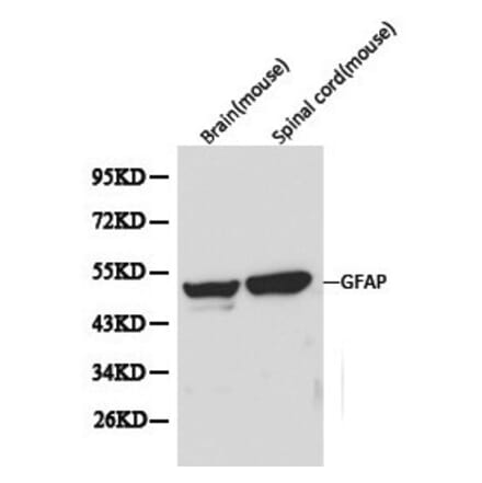 Anti-GFAP Antibody from Bioworld Technology (BS6460) - Antibodies.com