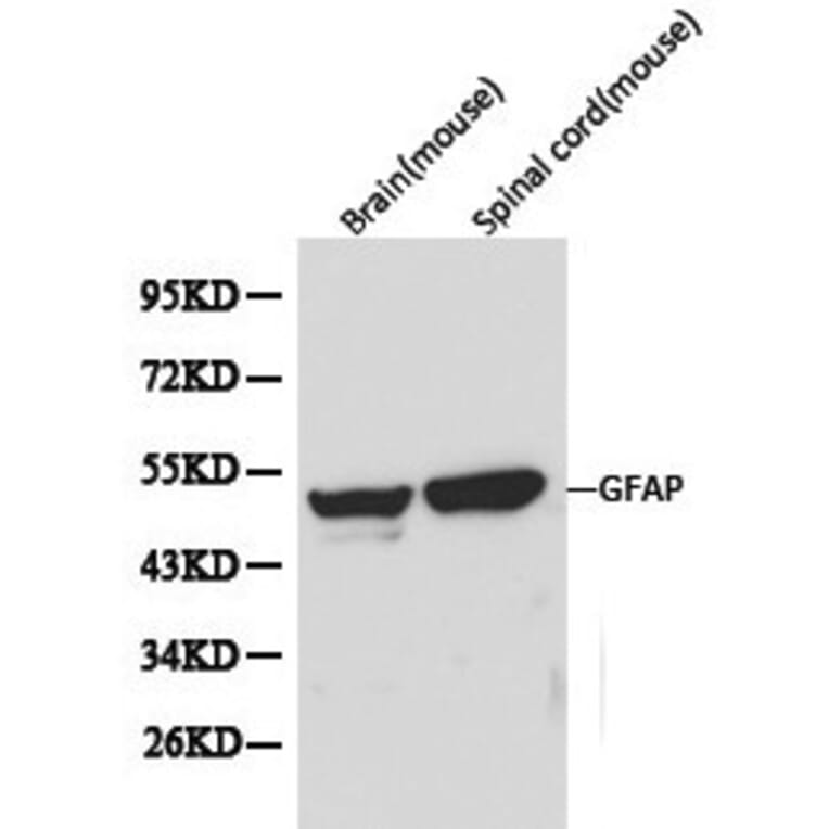 Anti-GFAP Antibody from Bioworld Technology (BS6460) - Antibodies.com