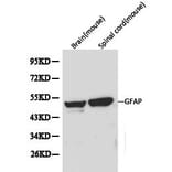 Anti-GFAP Antibody from Bioworld Technology (BS6460) - Antibodies.com
