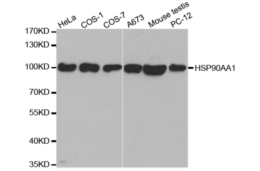 Anti-HSP90α Antibody from Bioworld Technology (BS6461) - Antibodies.com