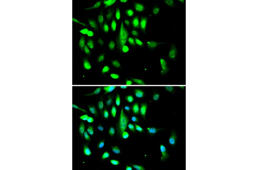 Anti-Cdk1/Cdc2 Antibody from Bioworld Technology (BS6467) - Antibodies.com