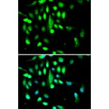 Anti-Cdk1/Cdc2 Antibody from Bioworld Technology (BS6467) - Antibodies.com