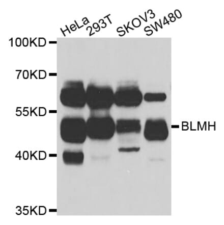 Anti-BLMH Antibody from Bioworld Technology (BS6469) - Antibodies.com