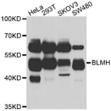 Anti-BLMH Antibody from Bioworld Technology (BS6469) - Antibodies.com