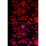 Anti-BLMH Antibody from Bioworld Technology (BS6469) - Antibodies.com