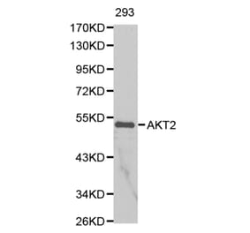 Anti-AKT2 Antibody from Bioworld Technology (BS6473) - Antibodies.com