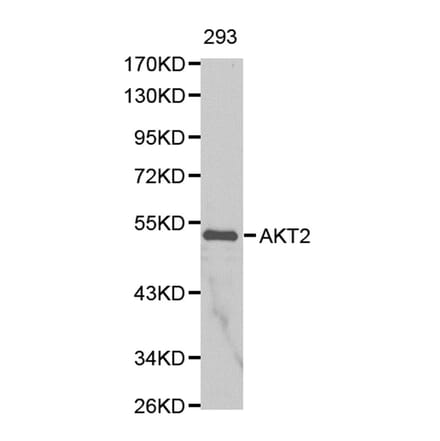 Anti-AKT2 Antibody from Bioworld Technology (BS6473) - Antibodies.com