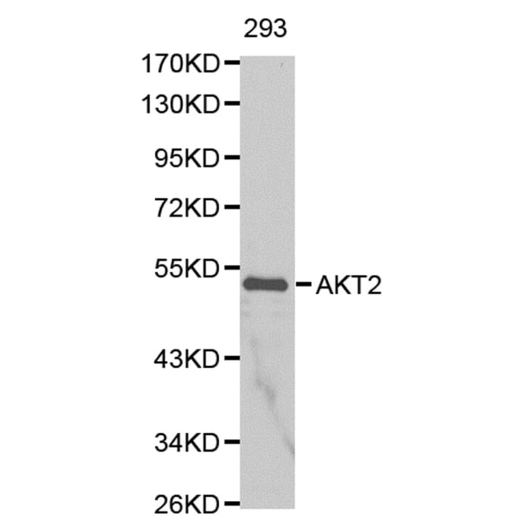 Anti-AKT2 Antibody from Bioworld Technology (BS6473) - Antibodies.com