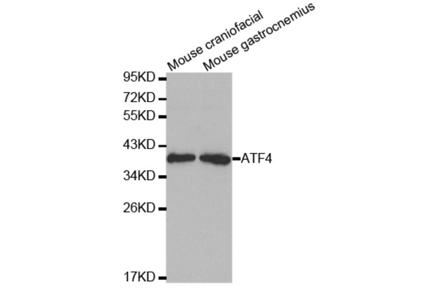 Anti-ATF4 Antibody from Bioworld Technology (BS6475) - Antibodies.com