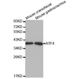 Anti-ATF4 Antibody from Bioworld Technology (BS6475) - Antibodies.com