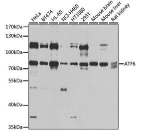 Anti-ATF6 Antibody from Bioworld Technology (BS6476) - Antibodies.com