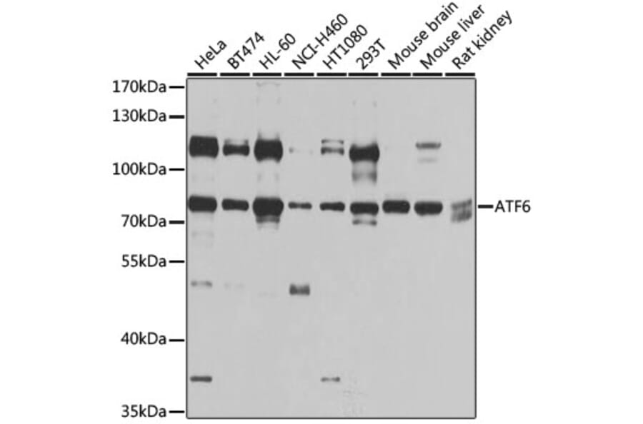 Anti-ATF6 Antibody from Bioworld Technology (BS6476) - Antibodies.com