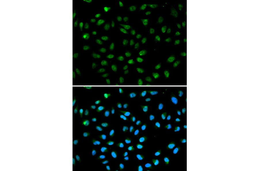 Anti-ATF6 Antibody from Bioworld Technology (BS6476) - Antibodies.com