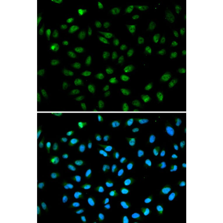 Anti-ATF6 Antibody from Bioworld Technology (BS6476) - Antibodies.com