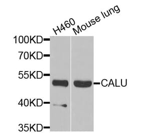 Anti-CALU Antibody from Bioworld Technology (BS6483) - Antibodies.com