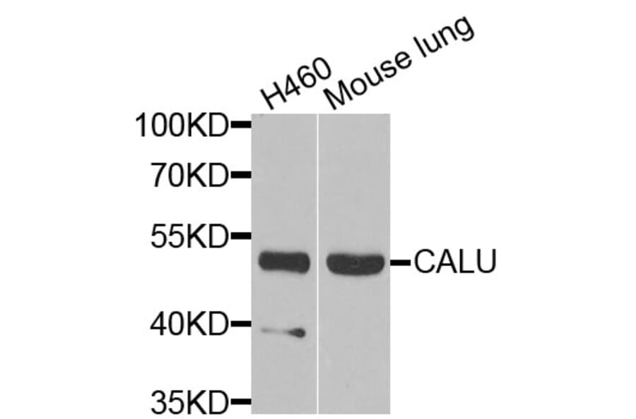 Anti-CALU Antibody from Bioworld Technology (BS6483) - Antibodies.com