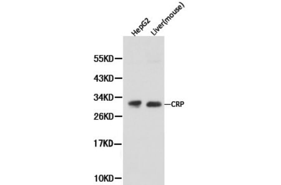Anti-CRP Antibody from Bioworld Technology (BS6484) - Antibodies.com